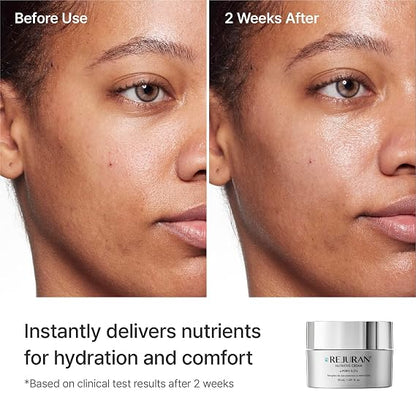 REJURAN Nutritive Cream